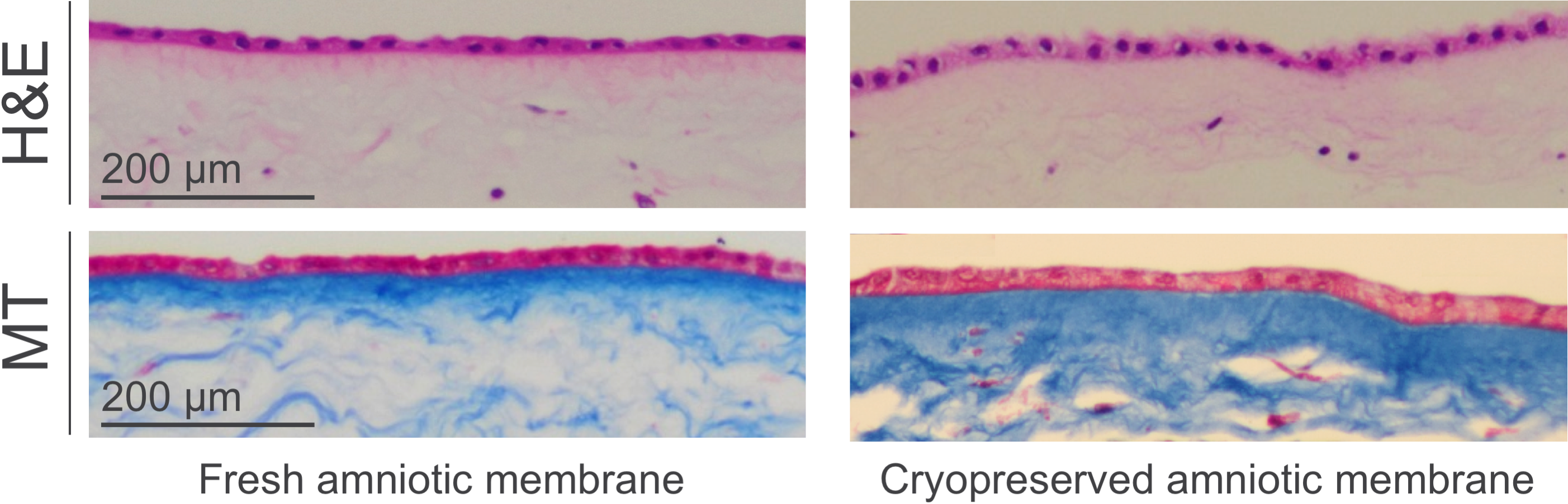 Cryopreservation Science Of Placental Tissues