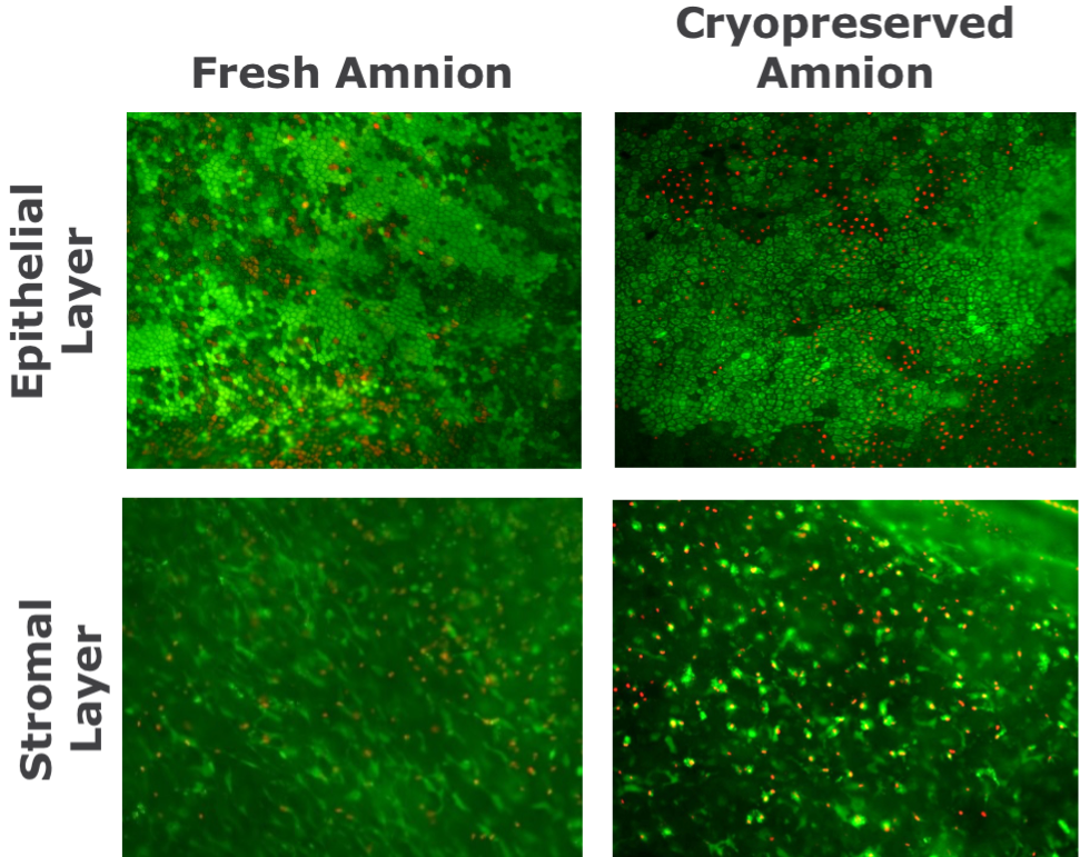 Cryopreservation Science Of Placental Tissues